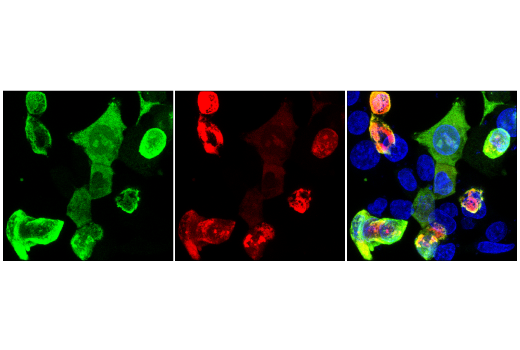 Immunofluorescence Image 1: Cas9 (7A9-3A3) Mouse mAb (Alexa Fluor® 594 Conjugate)