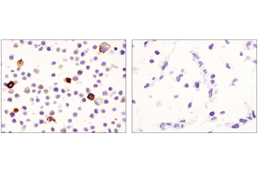  Image 46: Mouse Reactive M1 vs M2 Macrophage IHC Antibody Sampler Kit