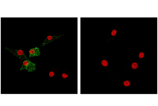  Image 55: Mouse Immune Cell Phenotyping IHC Antibody Sampler Kit