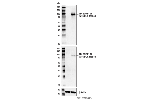 Western Blotting Image 2: CD180/RP105 Antibody