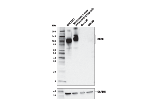  Image 9: Mouse Reactive M1 vs M2 Macrophage IHC Antibody Sampler Kit