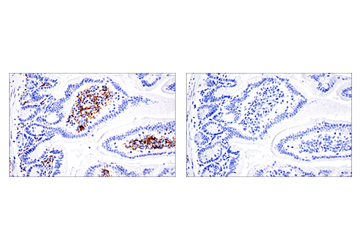  Image 78: Mouse Reactive M1 vs M2 Macrophage IHC Antibody Sampler Kit