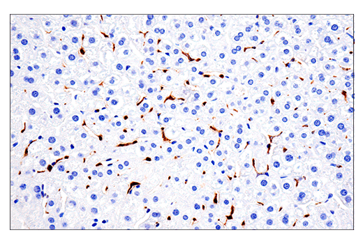 Immunohistochemistry Image 9: CD68 (E3O7V) Rabbit mAb
