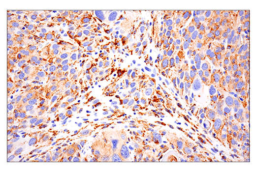  Image 73: Mouse Reactive M1 vs M2 Macrophage IHC Antibody Sampler Kit