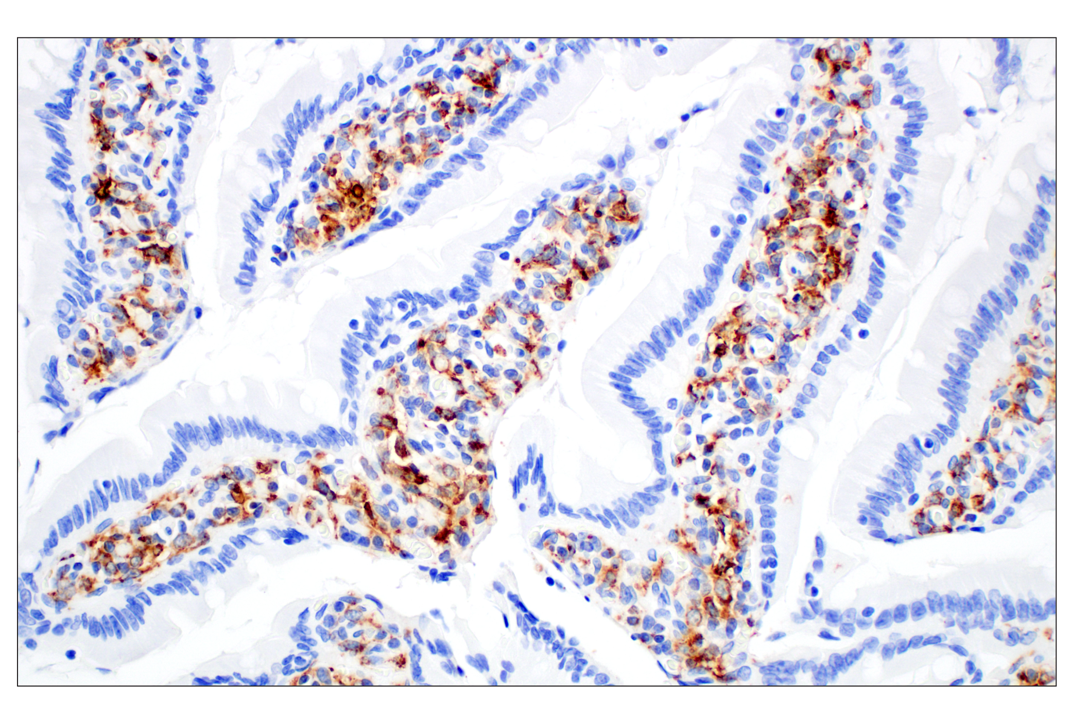 Image 71: Mouse Reactive M1 vs M2 Macrophage IHC Antibody Sampler Kit
