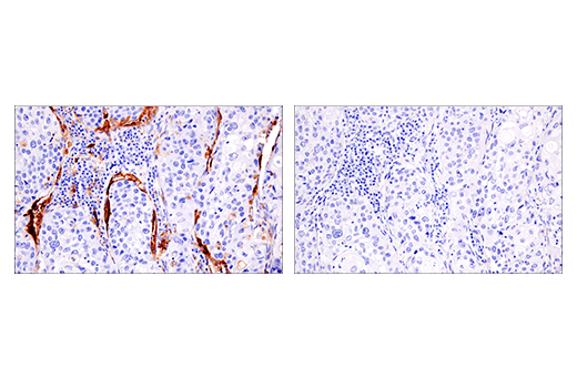  Image 56: Human Reactive M1 vs M2 Macrophage IHC Antibody Sampler Kit