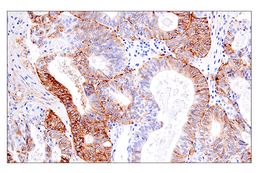  Image 64: Human Reactive M1 vs M2 Macrophage IHC Antibody Sampler Kit