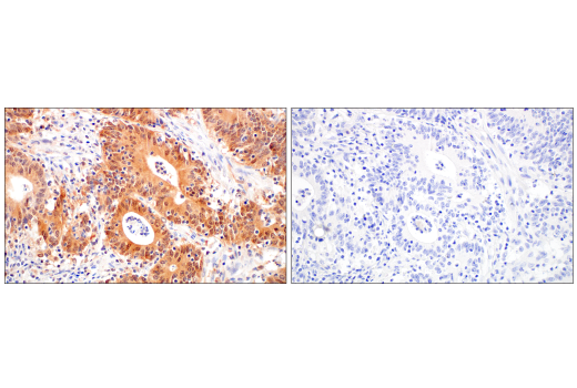 Immunohistochemistry Image 8: Caspase-1 (E4R8K) Rabbit mAb