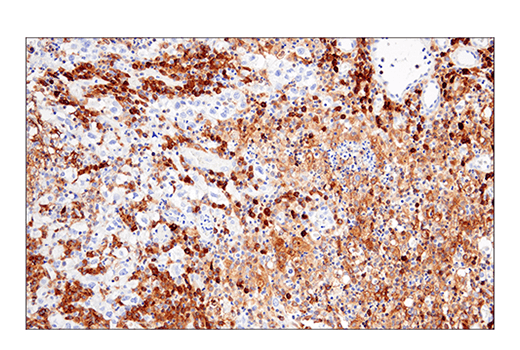 Immunohistochemistry Image 2: CRACC/SLAMF7/CD319 (E5C4M) Rabbit mAb (BSA and Azide Free)