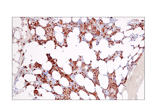 Immunohistochemistry Image 6: CRACC/SLAMF7/CD319 (E5C4M) Rabbit mAb (BSA and Azide Free)