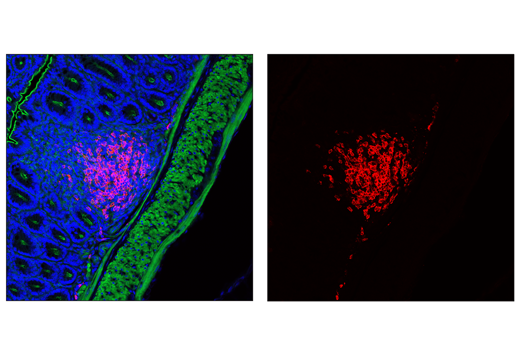 Immunofluorescence Image 1: CD20 Antibody