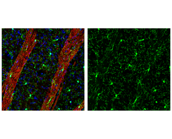 Immunofluorescence Image 1: CD45 (D3F8Q) Rabbit mAb (BSA and Azide Free)