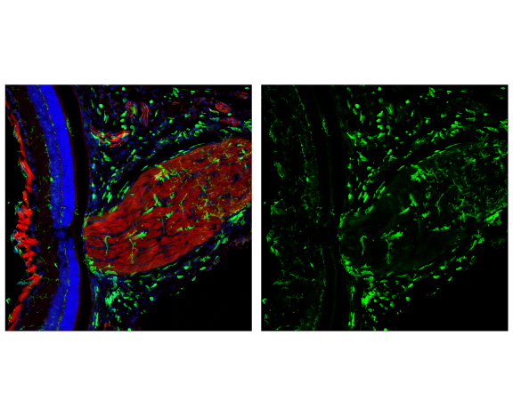 Immunofluorescence Image 2: CD45 (D3F8Q) Rabbit mAb (BSA and Azide Free)
