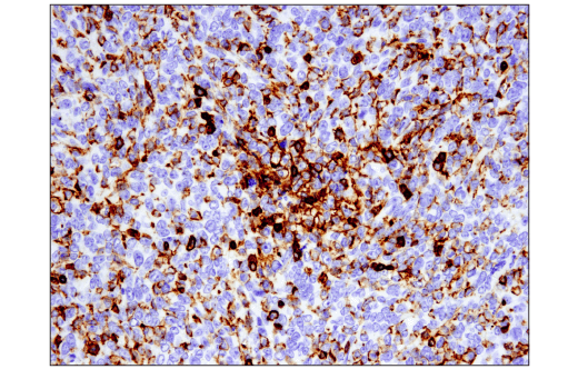 Immunohistochemistry Image 1: CD45 (D3F8Q) Rabbit mAb (BSA and Azide Free)