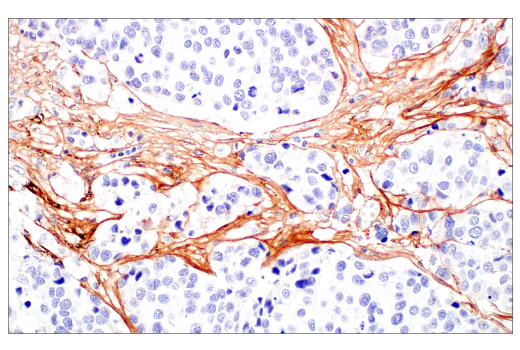 Immunohistochemistry Image 6: COL3A1 (E8D7R) XP® Rabbit mAb (BSA and Azide Free)