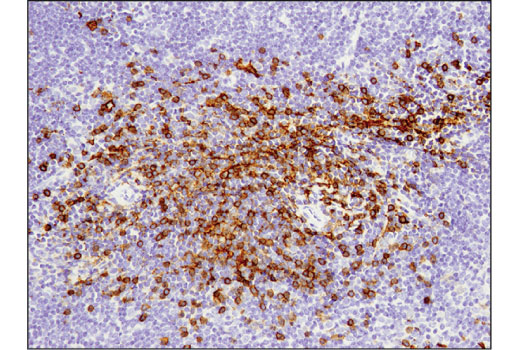 Immunohistochemistry Image 2: CD8α (D4W2Z) XP® Rabbit mAb