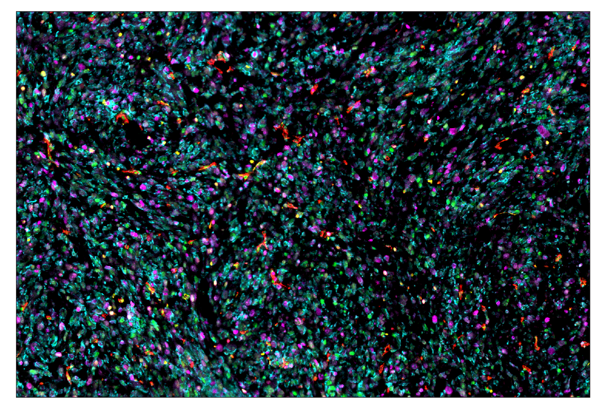 Immunohistochemistry Image 7: CD31 (PECAM-1) (D8V9E) & CO-0050-647 SignalStar™ Oligo-Antibody Pair