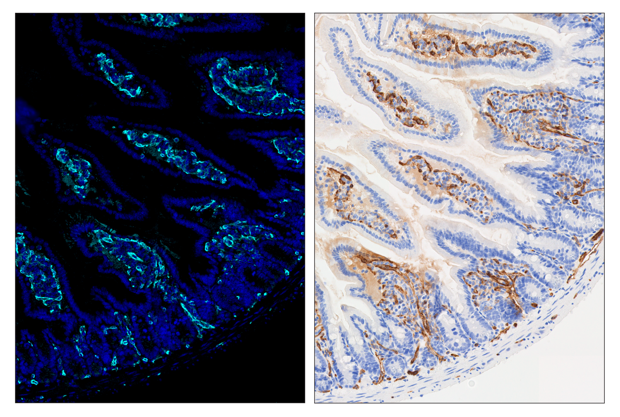 Immunohistochemistry Image 6: CD31 (PECAM-1) (D8V9E) & CO-0050-750 SignalStar™ Oligo-Antibody Pair