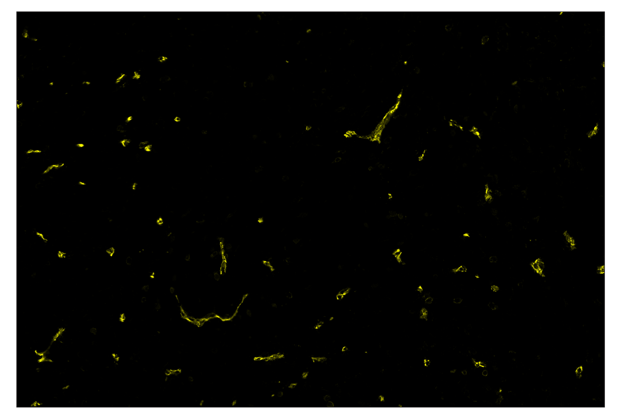 Immunohistochemistry Image 3: CD31 (PECAM-1) (D8V9E) & CO-0050-594 SignalStar™ Oligo-Antibody Pair