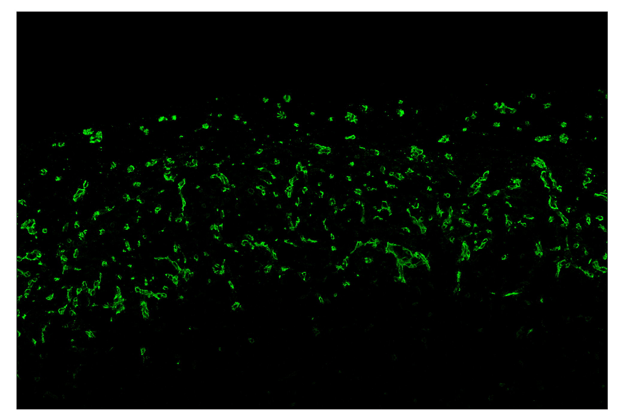 Immunohistochemistry Image 2: CD31 (PECAM-1) (D8V9E) & CO-0050-647 SignalStar™ Oligo-Antibody Pair