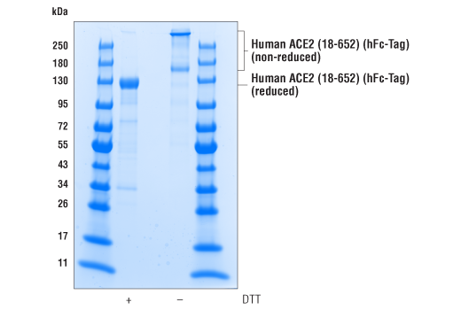  Image 5: Human ACE2 (18-652) Recombinant Protein (hFc-Tag)