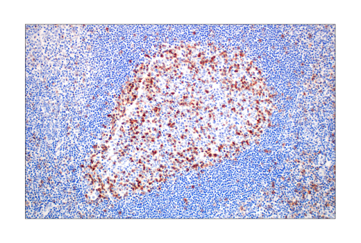  Image 78: Human Exhausted CD8+ T Cell IHC Antibody Sampler Kit