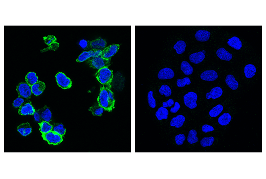  Image 72: Human Exhausted T Cell Antibody Sampler Kit