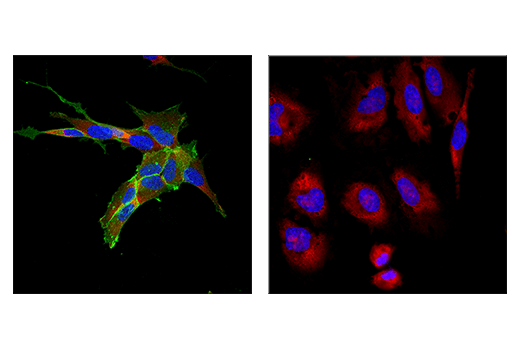 Immunofluorescence Image 2: NCAM1 (CD56) (E7X9M) XP® Rabbit mAb
