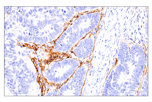 Immunohistochemistry Image 2: NCAM1 (CD56) (E7X9M) XP® Rabbit mAb