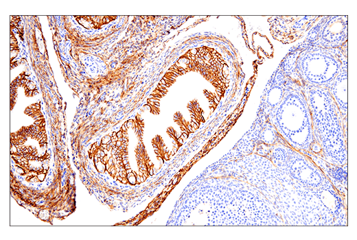 Immunohistochemistry Image 7: NCAM1 (CD56) (E7X9M) XP® Rabbit mAb