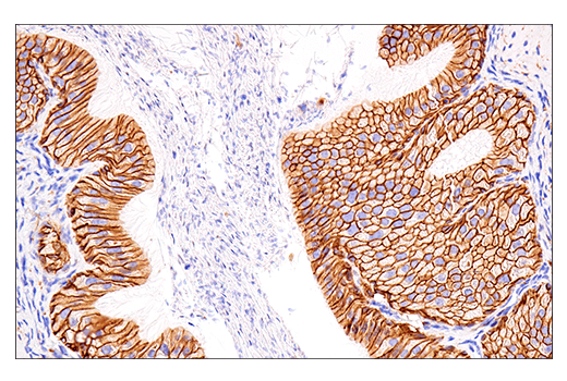 Immunohistochemistry Image 8: NCAM1 (CD56) (E7X9M) XP® Rabbit mAb