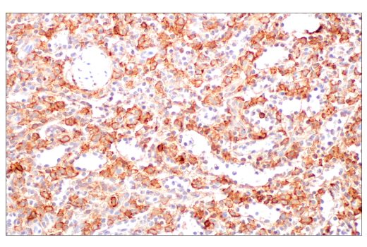  Image 65: Human Immune Cell Phenotyping IHC Antibody Sampler Kit