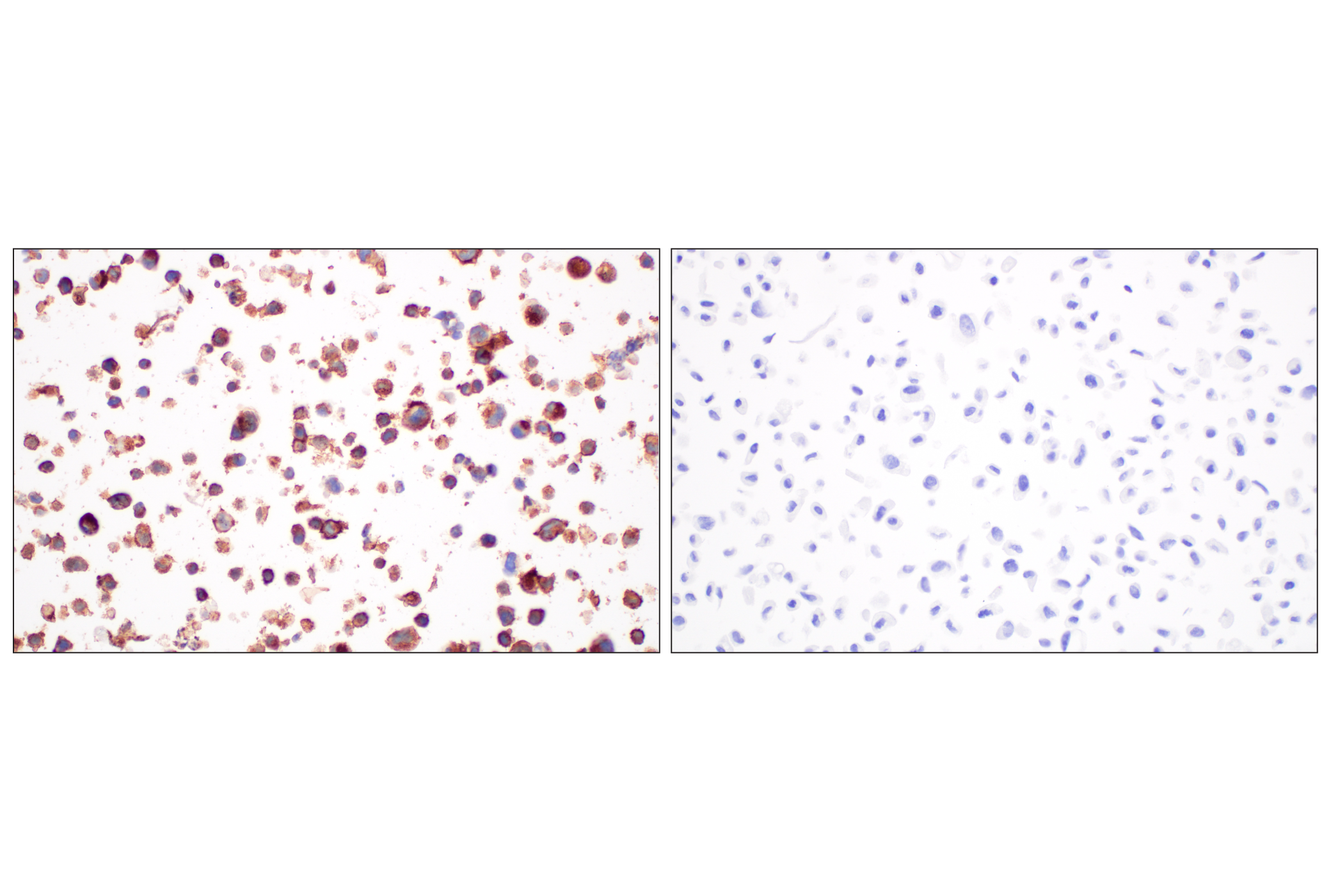 Immunohistochemistry Image 9: CD4 (MSVA-004R) Rabbit mAb