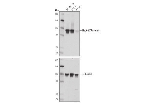 Western Blotting Image 1: Na,K-ATPase α1 (D4Y7E) Rabbit mAb (BSA and Azide Free)