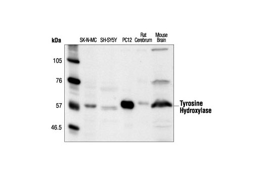 Tyrosine Hydroxylase Antibody Cell Signaling Technology 4671