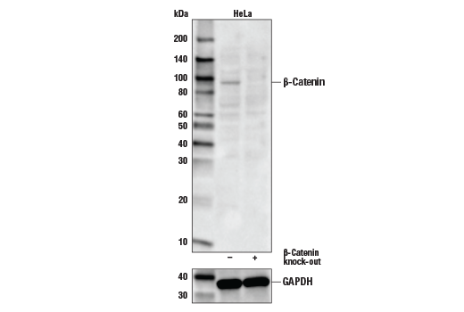 Non Phospho Active B Catenin Ser33 37 Thr41 D13a1 Rabbit Mab Cell Signaling Technology