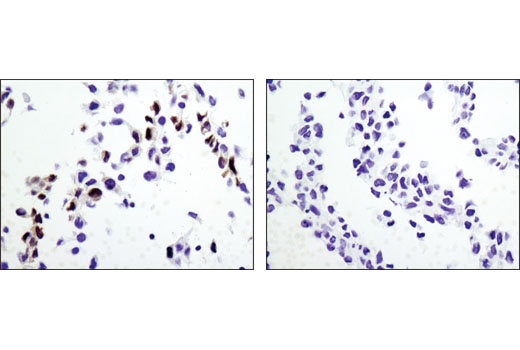 使用 RKIP (D42F3) Rabbit mAb 对石蜡包埋的野生型 MEF（左图）和 RKIP 敲除型 MEF（右图）细胞沉淀物进行免疫组织化学分析。细胞由伊利诺伊州芝加哥大学的 Marsha Rosner 博士惠赠。
