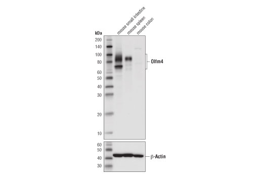使用 Olfm4 (D6Y5A)（上图）和 β-Actin (D6A8)（下图），对小鼠小肠 （阳性）、小鼠脾脏 （阳性）和小鼠结肠 （阴性）细胞的提取物进行蛋白质印迹分析。