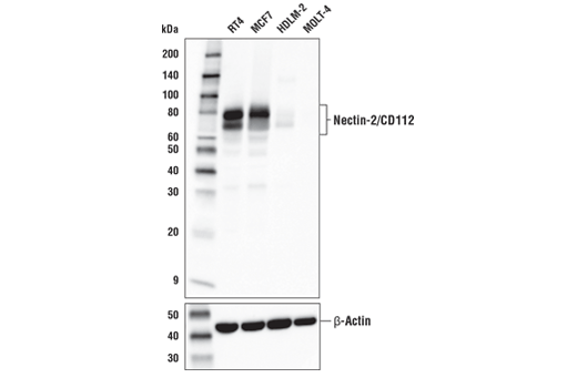 使用 Nectin-2/CD112 (D8D3F) （上图）和 β-肌动蛋白 (D6A8) （下图）对不同人细胞的提取物进行蛋白质印迹分析。