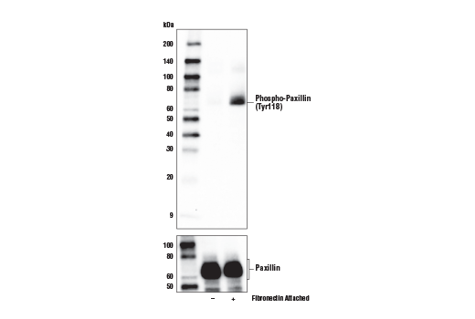 使用 Phospho-Paxillin (Tyr118) (E9U9F) Rabbit mAb（上图）和 Paxillin (D9G12) Rabbit mAb #12065（下图）对未处理的 (-) 或经诱导黏附在纤连蛋白涂层板表面（10 μg/ml，1 小时；+）上的悬浮 HeLa 细胞的提取物进行蛋白印迹分析。