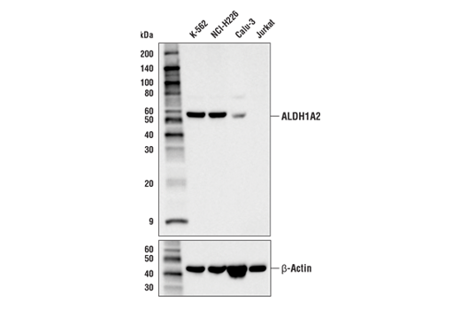 使用 ALDH1A2 (E6O6Q)（上图）和 β-Actin (D6A8)（下图）对不同细胞系的提取物进行蛋白质印迹分析。根据公开提供的生物信息数据库，ALDH1A2 在各细胞系中的表达水平与预期一致。