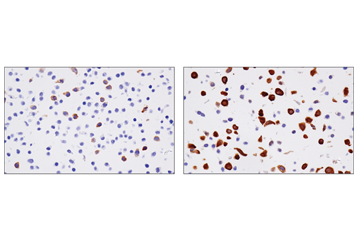使用 RRM2 (E7Y9J) 对未经（左图）或已经 Aphidicolin（右图）处理的石蜡包埋的 HT-29 细胞沉淀物进行免疫组织化学分析。