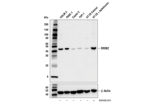 使用 RRM2 (E7Y9J)（上图）或 β-Actin (D6A8)（下图）对不同细胞系的提取物进行蛋白质印迹分析。在泳道 5 和 6 中，HT-29 细胞用溶剂对照 (-) 或 Aphidicolin（10 μg/mL，24 小时；+）处理，表明 RRM2 在 G1/S 期边界时表达高。