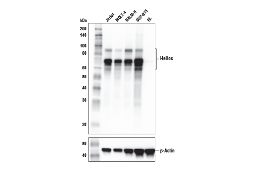 使用 Helios (E4L5U) Rabbit mAb（上图）或 β-Actin (D6A8) Rabbit mAb #8457（下图）对不同细胞系的提取物进行蛋白印迹分析。正如预计的一样，RL-7 细胞不表达 Helios 蛋白。