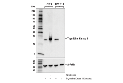 使用 Thymidine Kinase 1 (E2H7Z) Rabbit mAb（上图）或 β-Actin (D6A8) Rabbit mAb #8457（下图）对空载处理 (-) 或经 aphidicolin 处理（10 μg/ml，24 小时；+）的 HT-29 细胞和野生型 (-) 或胸苷激酶 1 敲除型 (+) HCT  116 细胞的提取物进行蛋白质印迹分析。