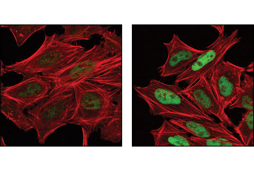使用 Phospho-c-Jun (Ser73) (D47G9)（绿色）对未经（左图）或经 anisomycin（右图）处理的 HeLa 细胞进行共聚焦免疫荧光分析。肌动蛋白纤丝用 DY-554 Phalloidin 进行标记（红色）。