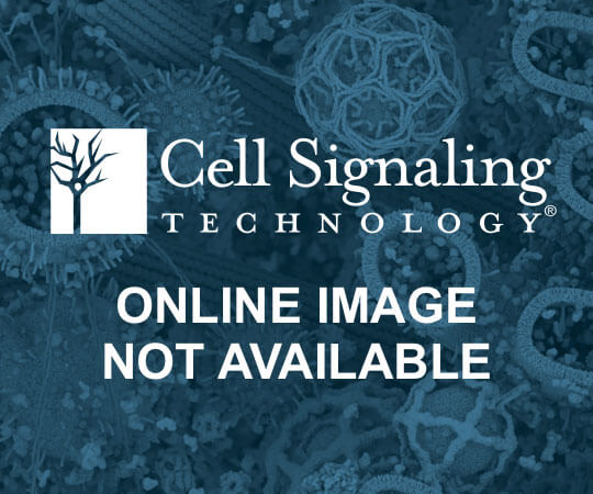 Cleaved Caspase-3 (Asp175) Antibody | Cell Signaling Technology