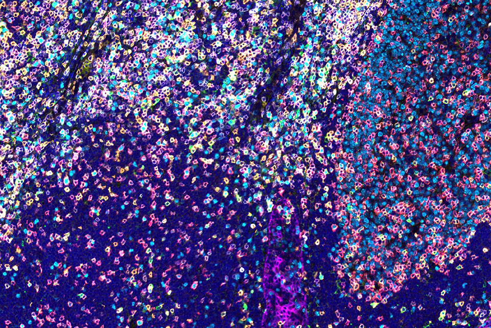 SignalStar™ multiplex immunohistochemical analysis of paraffin-embedded human tonsil using ICOS (D1K2T™) & CO-0027-647 SignalStar™ Oligo-Antibody Pair #24147.