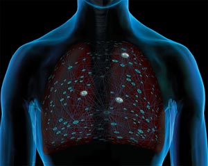 Digital illustration of human upper body with a scientific signaling pathway overlaid onto lungs to represent lung cancer signaling.