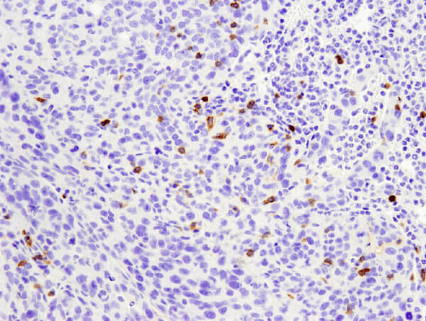 CD4 25229 小鼠肺肿瘤